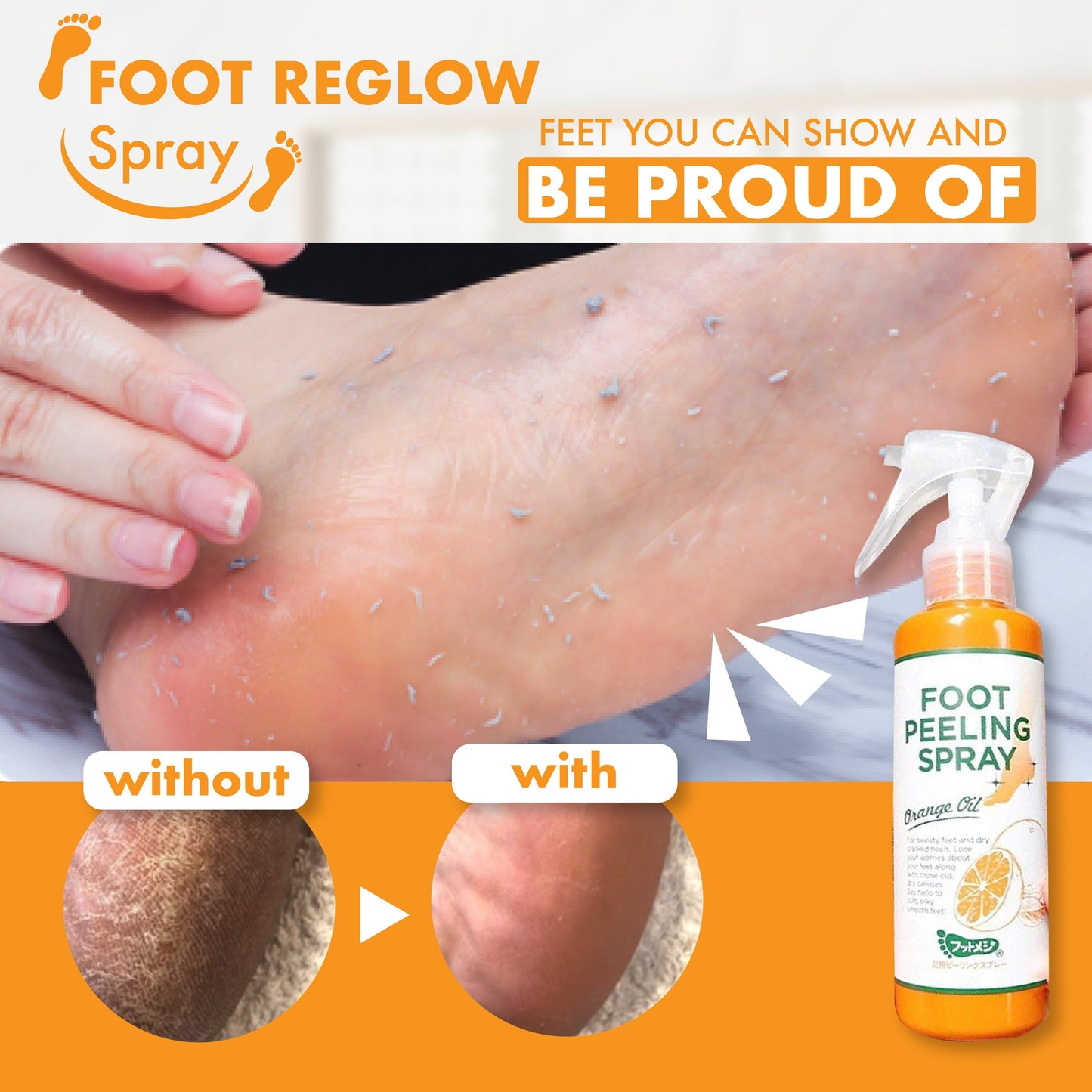 【Mega Sale!】Callus Off Foot Reglow Spray