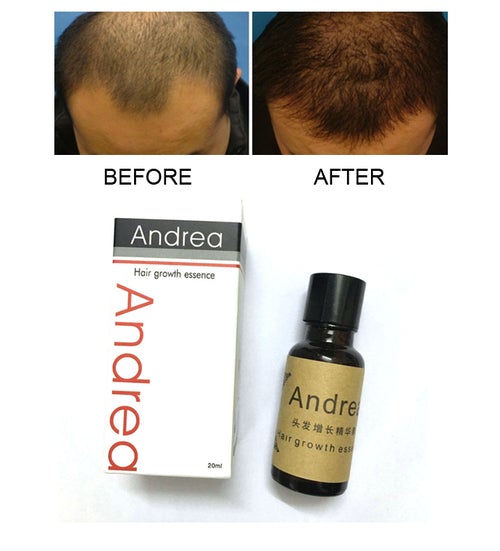 Andrea Organic Hair Growth Essence
